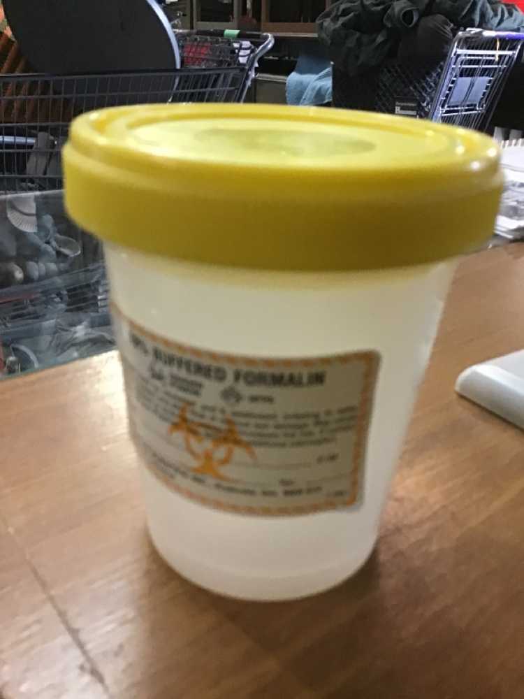 Biohazard Container